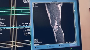 how to do non ce  lower limbs angiography on GE 1.5T with full detailed explanation