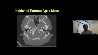 Challenging Otology Cases