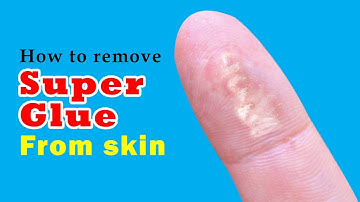 How to remove super glue from skin | Easy and Effective Method