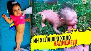 Кудокони Гайри Одди | NECATOP