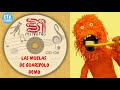 31 Minutos: Las muelas de Guaripolo -  VERSION DEMO - 2011