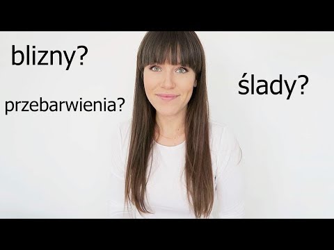 Wideo: Usunięcie Znamion, Konsekwencje