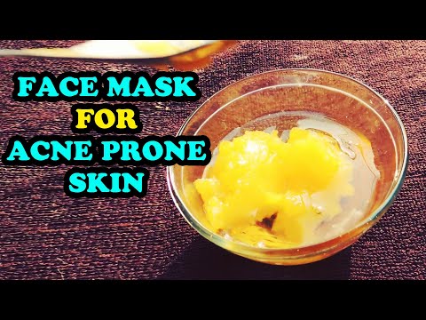 HOW TO GET RID OF ACNE SCARS | BEST FACE MASK FOR ACNE | ACNE SCAR REMOVAL | GET CLEAR GLOWING SKIN