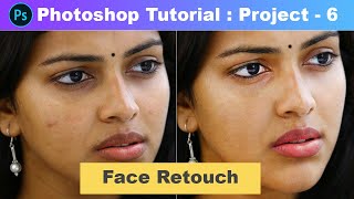 Face Clean & Retouch, Remove Blemishes, Scars & Pimples - Photoshop Tutorial  [Part 50] [Project 6]