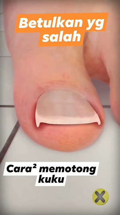 Cara potong kuku kaki yang benar