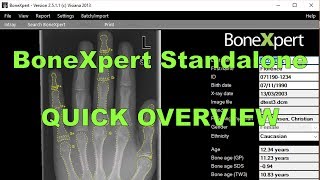 BoneXpert Standalone: Quick overview screenshot 5