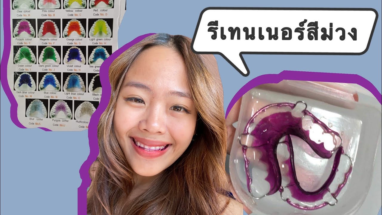 รีเทนเนอร์สีม่วง สีม่วงแบบไหน ใส่แล้วเป็นยังไง ????