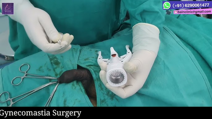 Liza Brazis yalangoch