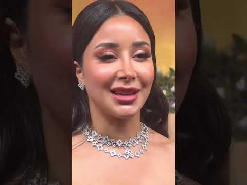 بدون فلاتر الكاميرات في جوي أوورد تظهر عيوب في بشرة النجمات 