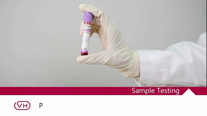 Operation video-VH50