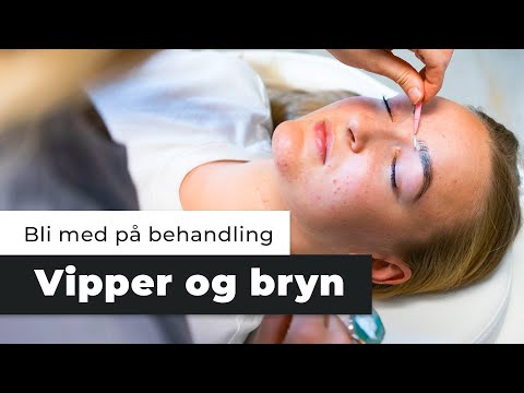 Video: Hvorfor vipper vindguden?