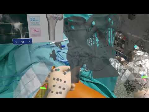 20220418 084340 HoloLens