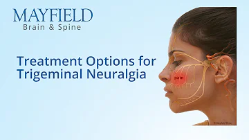 What foods can trigger trigeminal neuralgia?