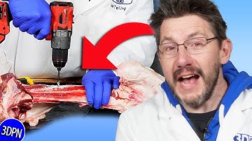 Dr Joel & the Bone Screw