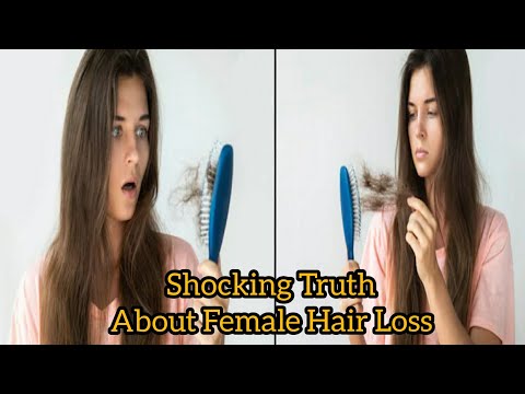 hair-loss:-shocking-truth-about-female-hair-loss-|-female-hair-loss-|-the-health-ask-|-(loss-hair)