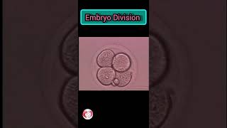 Embryo Grading implantation ivf pregnancytips pregnancycare ovulation ivftreatmentforpregnancy