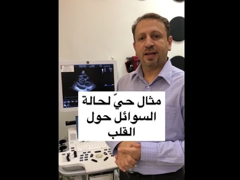 مثال حي للسوائل حول القلب د عمرو رشيد