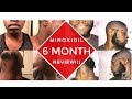 Growing a Beard With Minoxidil: A Black Man's Experience 6 MONTH REVIEW!! (Part 1)