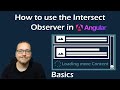 Mastering Intersection Observer API: Lazy Loading Basics | Part 1