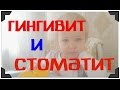 СТОМАТИТ и ГИНГИВИТ / симптомы / наша проблема и лечение