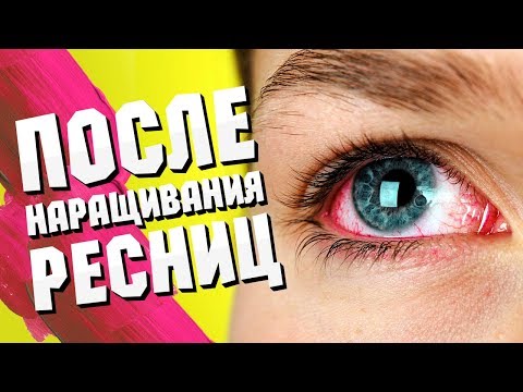 Видео: Проблемы с наращиванием ресниц