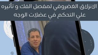 شدة الانزلاق الغضروفي لمفصل الفك قد تؤثر علي التحكم في عضلات الوجه .