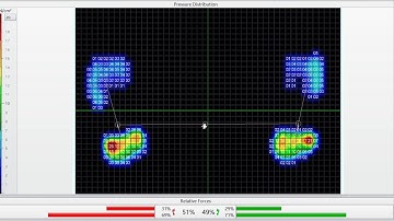 Stance Analysis - Zebris