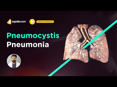 Videó: A Tüdő Gombás Fertőzése (pneumocystosis) Kutyáknál