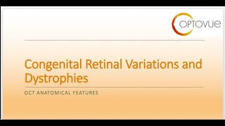OCT Interpretation Session 7: Congenital Retinal Variations and Dystrophies