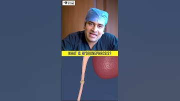 What is hydronephrosis | Kidney swelling | how kidney stone leads to swelling #hydronephrosis
