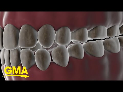 Video: Scottsdale AZ: Minimally Invasive Cosmetic Dentistry Experts