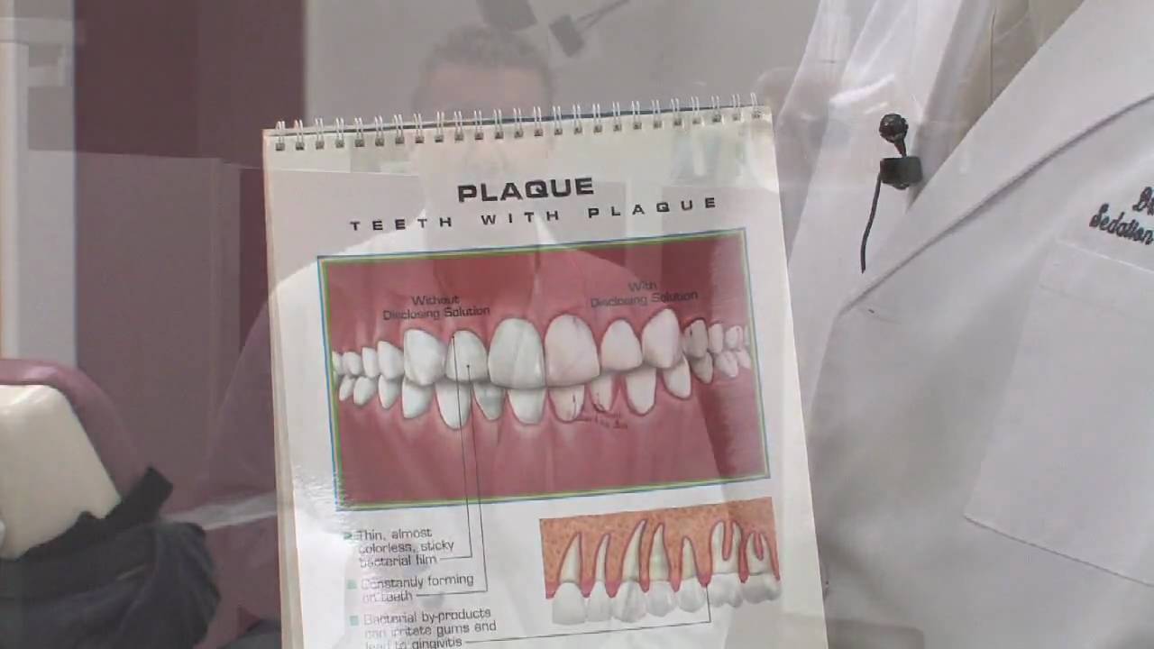 Dental Care for Teeth & Gums Can Peppermint, Spearmint & Almond Oil