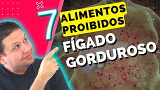 FÍGADO GORDUROSO, 7 ALIMENTOS PROIBIDOS PARA GORDURA NO FÍGADO, SINTOMAS DA ESTEATOSE HEPÁTICA.