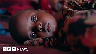 Half a million young children may die in Somalia warns UN - BBC News