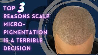 TOP 3 REASONS TO NOT GET #SCALPMICROPIGMENTATION | TOPLINESMP screenshot 2