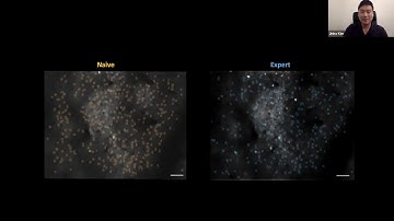 Talk: Behavioral and neural bases of tactile shape discrimination learning in head-fixed mice