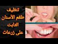 خطوة بخطوة تنظيف طقم الأسنان الثابت الدائم على الزرعات