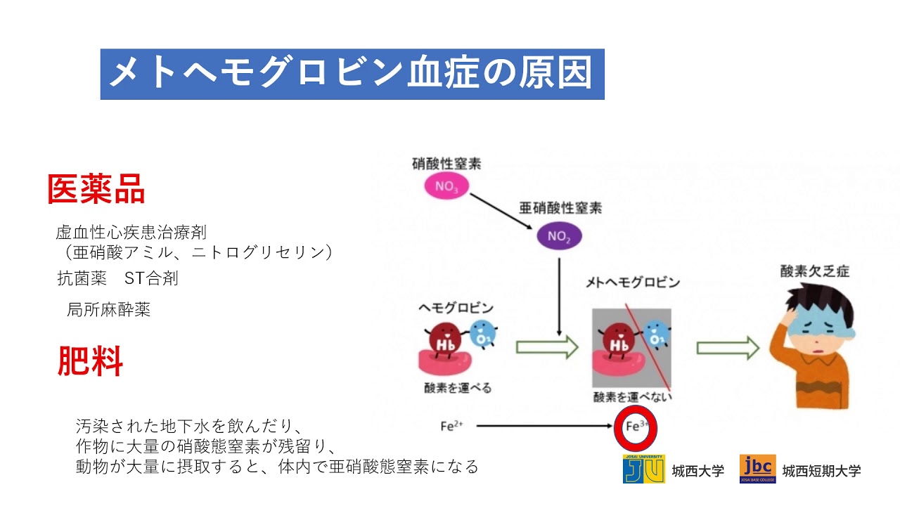 ヘモグロビン メト メトヘモグロビン血症の原因ってなに？症状や治療方法って？