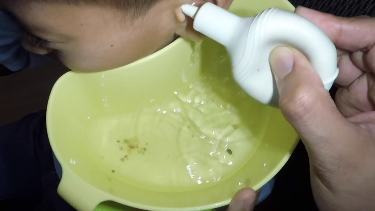 Ear Irrigation Best Earwax Removal YouTube