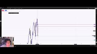 [Day 1] Restart: Building Consistency Before the $50K Topstep Challenge