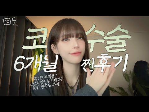 It's finally been six months since my rhinoplasty! Is there anything different?