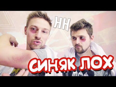 Как поставить себе синяк