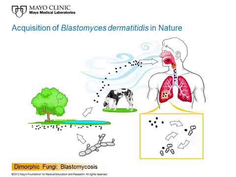 Dimorphic Fungi: Blastomycosis [Hot Topic]