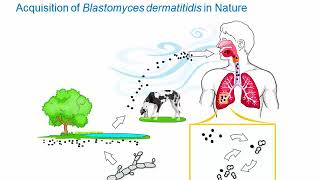 Dimorphic Fungi: Blastomycosis [Hot Topic]