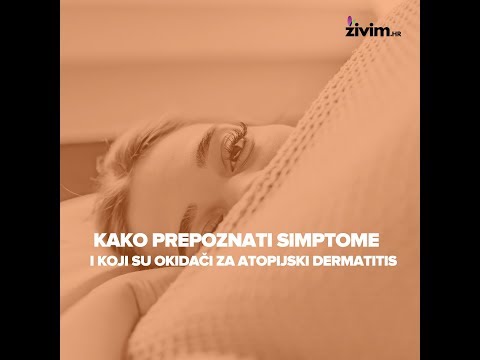 Video: Spongiotički Dermatitis: Uzroci, Simptomi I Liječenje