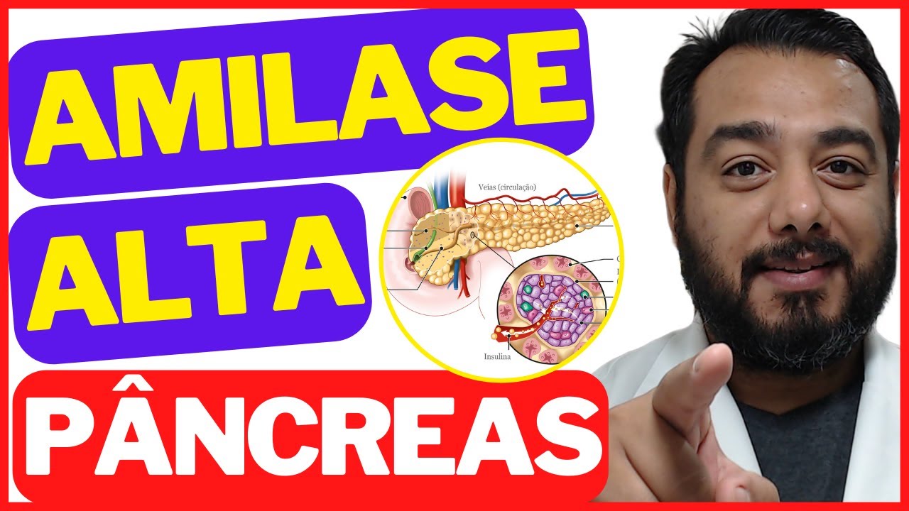 Enzima amilase alta no exame de sangue o que pode ser? Pancreatite Caxumba Bioquímica Enzima amilase alta no exame de sangue o que pode ser? Pancreatite Caxumba Bioquímica