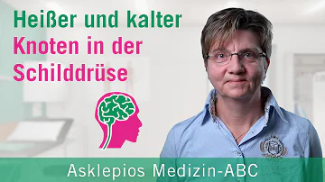 Wie heißen die Knoten?