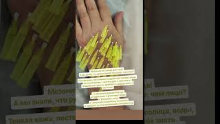 Вы знали, что руки стареют быстрее, чем лицо? Мезонити не только для лица! #beauticianvietnam