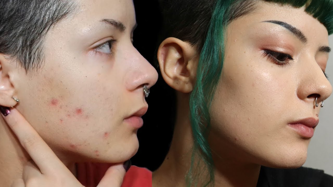 Como TRANSFORMEI minha pele com produtos naturais | TODOS OS MEUS CUIDADOS