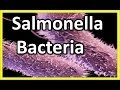 Salmonella - Bacteria : What is Salmonellosis? | salmonella symptoms